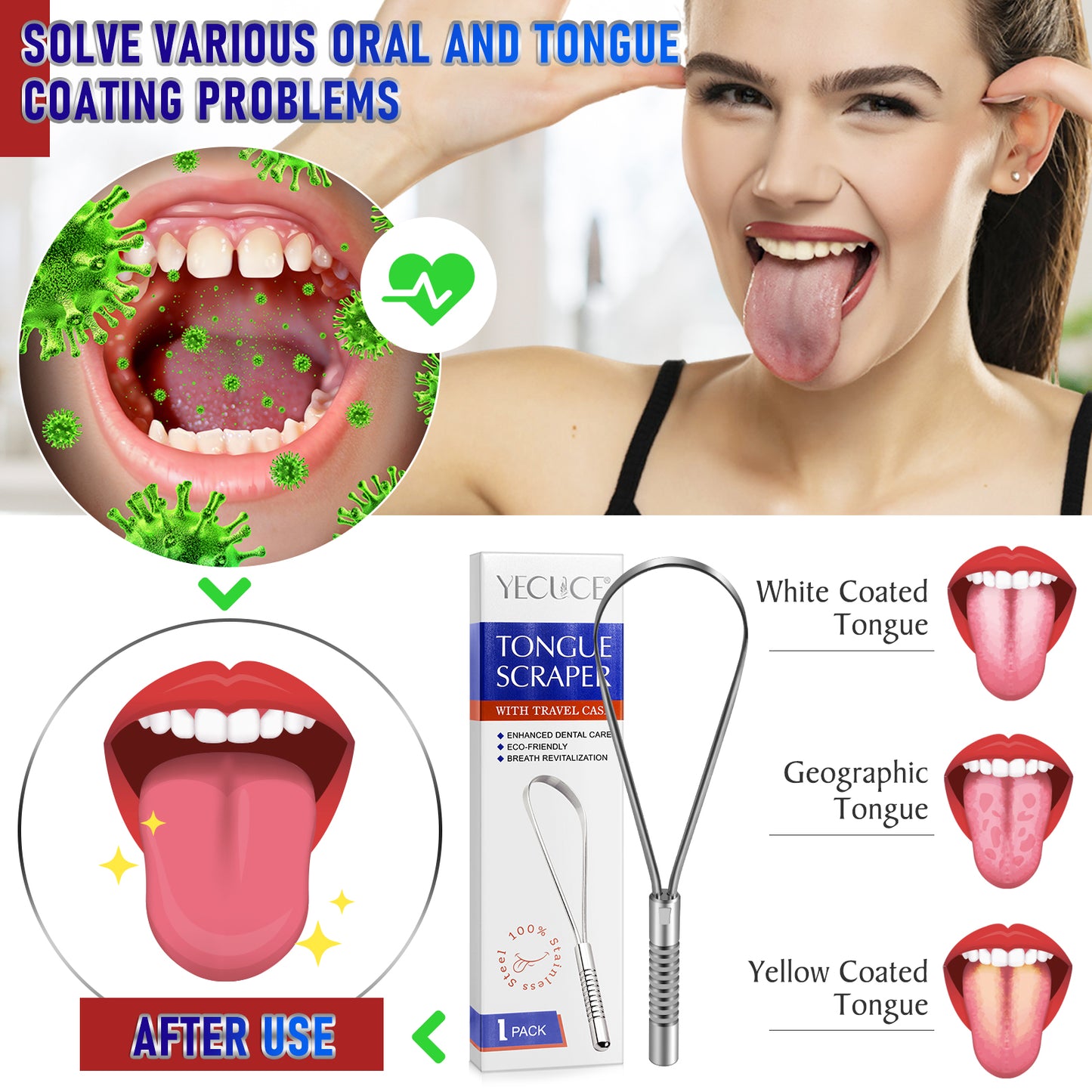 Yecuce Tongue Scraper WITH TRAVEL CASE