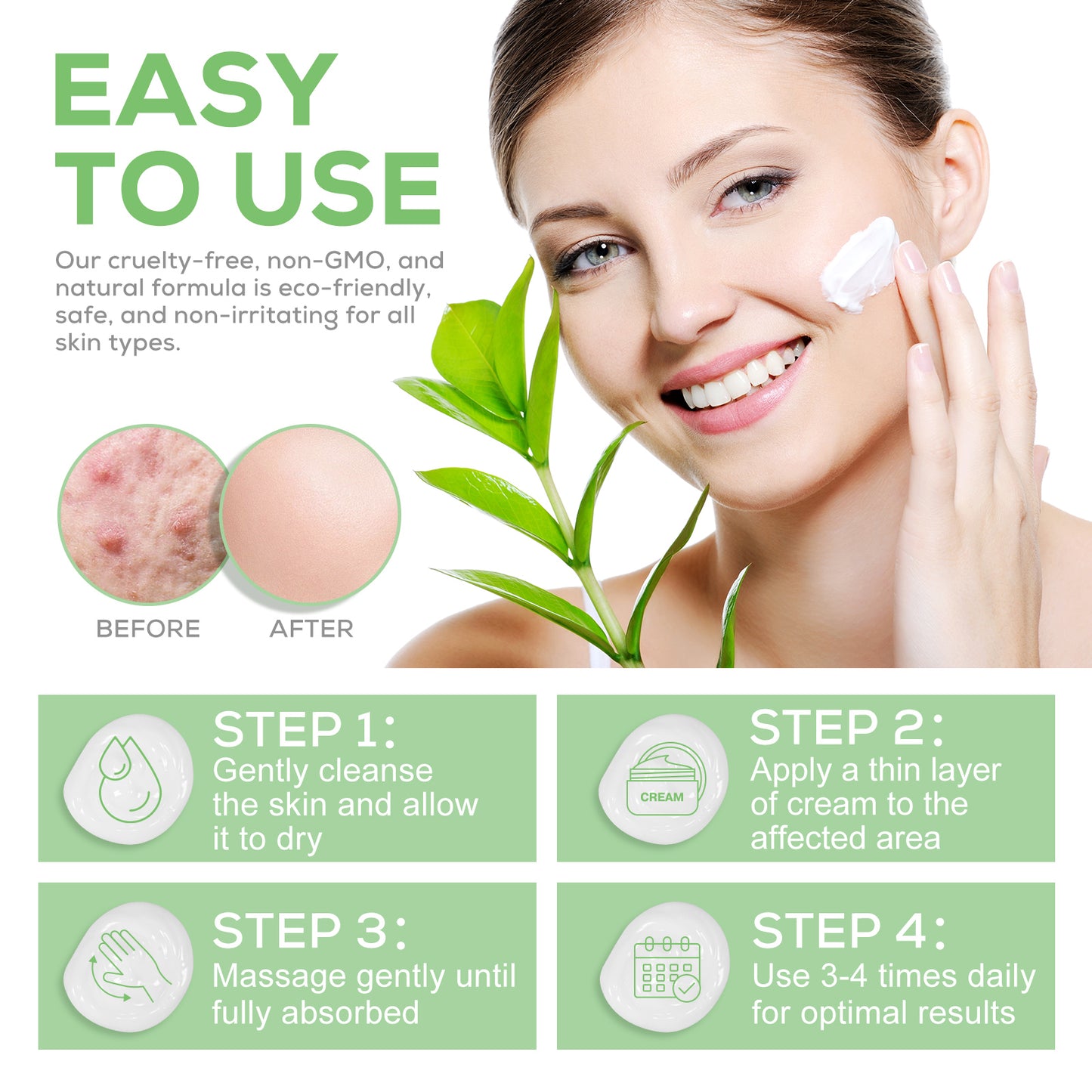 Yecuce Urea Cream 40 Percent for Dry Cracked Heels Feet Knees, Urea Cream for Feet, Callus Remover with 2% Salicylic Acid, Foot Moisturizer, Dead Skin Remover, Softener for Feet Care 120g