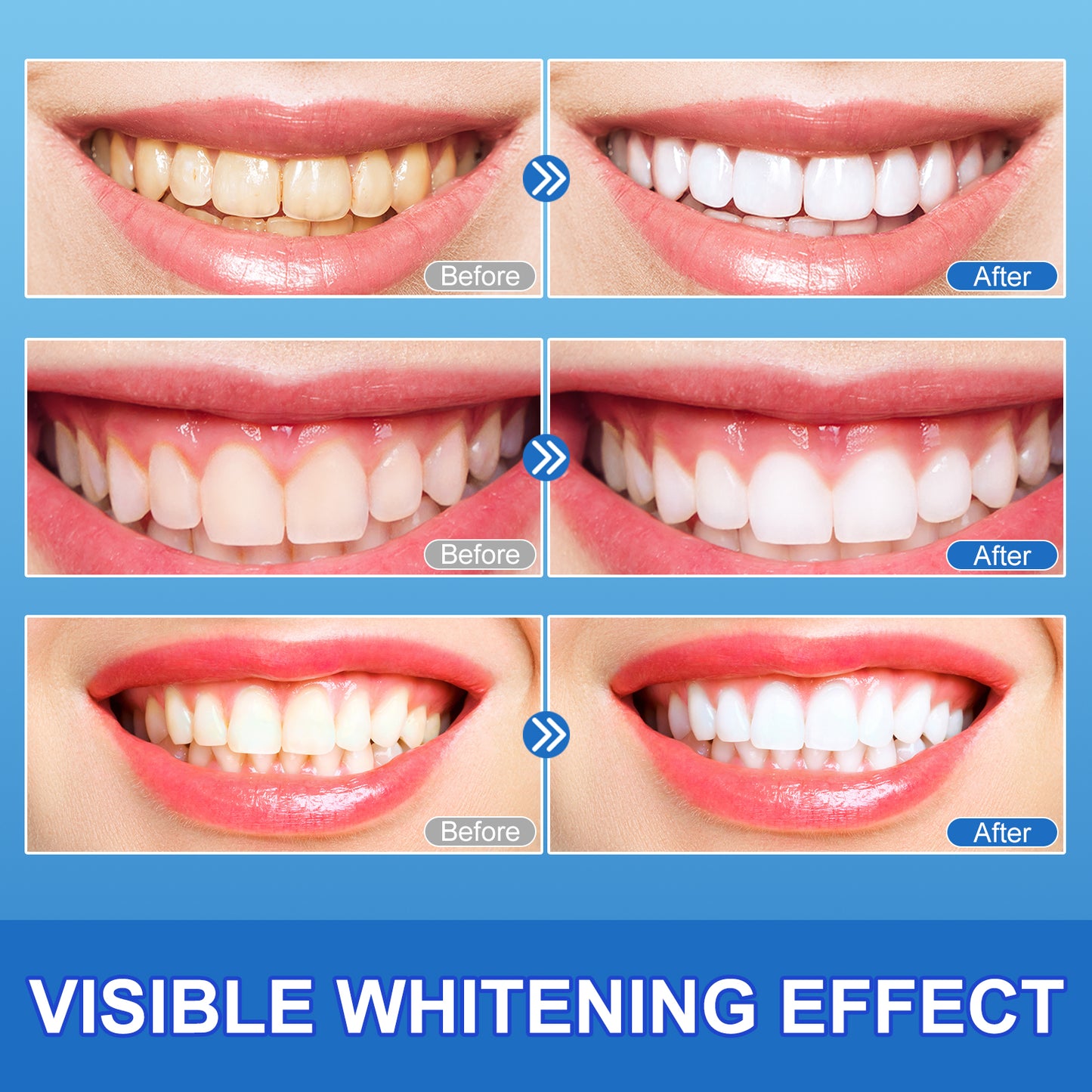 Yecuce Somall 9D Teeth Whitening Strips, Whitening Strips, Mild and Insensitive Fast Tooth Whitener,14p