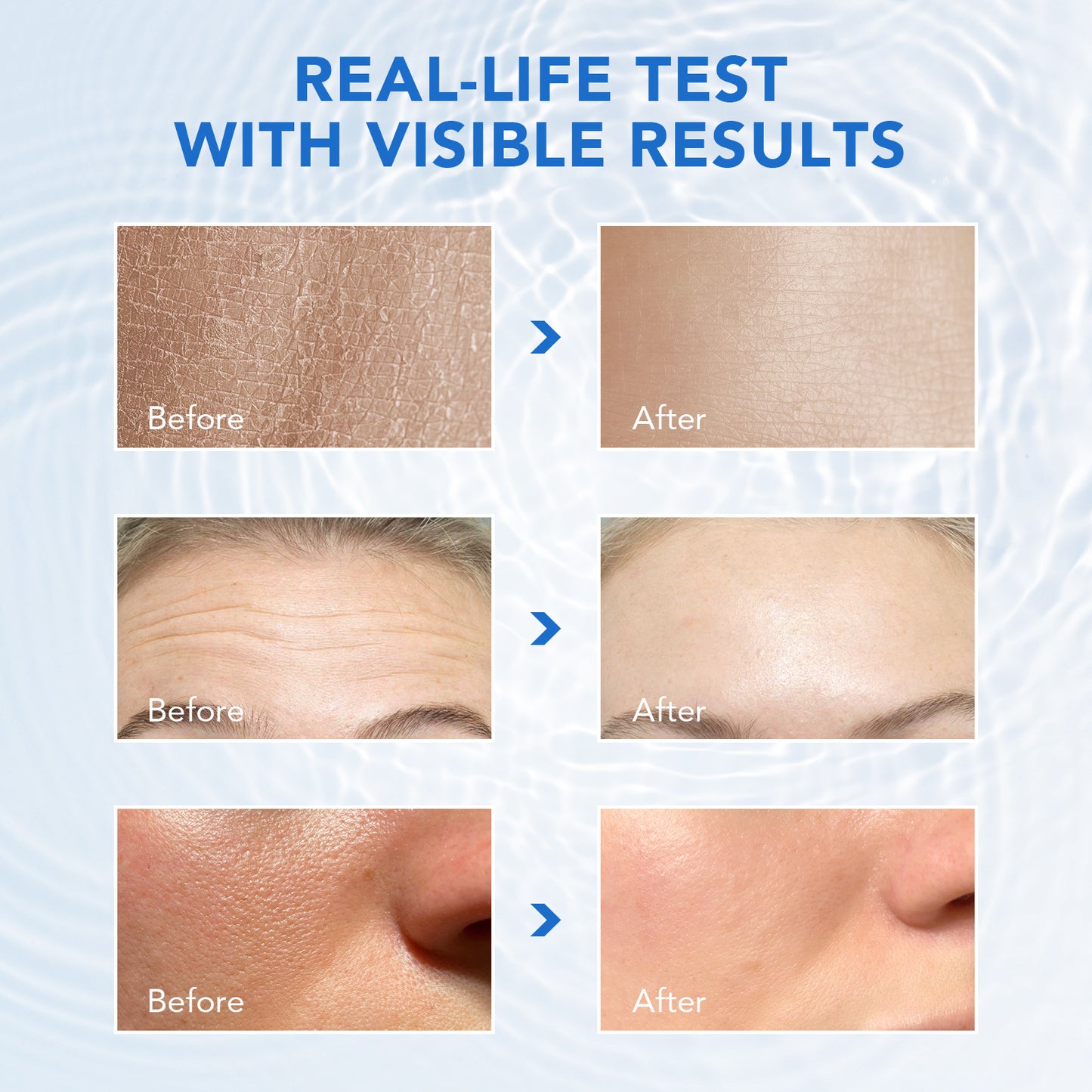YECUCE 3% Hyaluronic Acid Serum