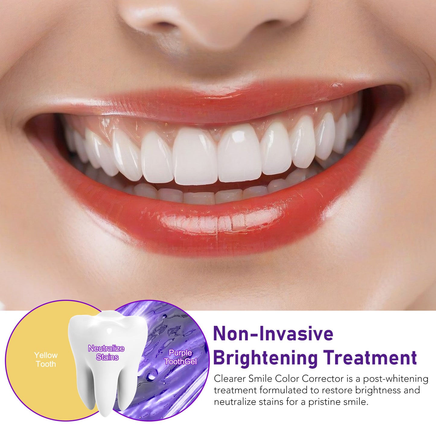 Yecuce Purple Toothpaste for Teeth Whitening, Instant Brightening Teeth Whitening Color Corrector, Gentle on Enamel White Brilliance Teeth Whitening Kit, Tooth Whitening Booster for Tooth Stain Removal, 30ml