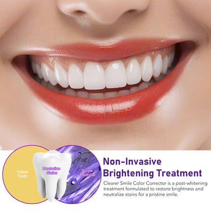 Yecuce Purple Toothpaste for Teeth Whitening, Instant Brightening Teeth Whitening Color Corrector, Gentle on Enamel White Brilliance Teeth Whitening Kit, Tooth Whitening Booster for Tooth Stain Removal, 30ml