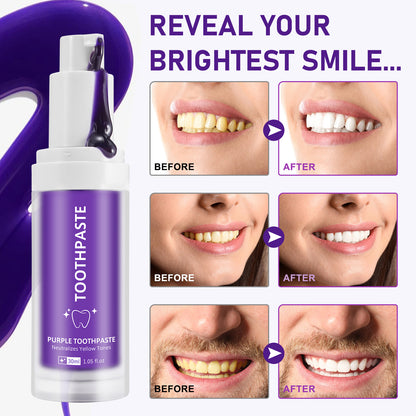 Yecuce Purple Toothpaste for Teeth Whitening, Instant Brightening Teeth Whitening Color Corrector, Gentle on Enamel White Brilliance Teeth Whitening Kit, Tooth Whitening Booster for Tooth Stain Removal, 30ml