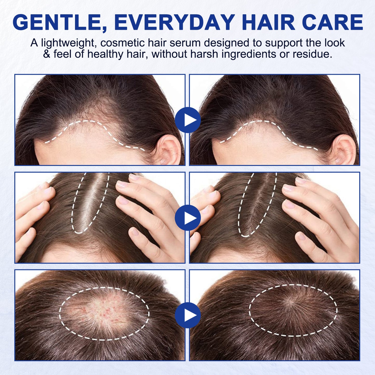 Hair Growth Serum Roll On, Hair Growth Serum Rosemary Oil Helps Hair Growth for Men and Women, Support Scalp Health, Fast-Absorbing, Non-Greasy (1PCS)